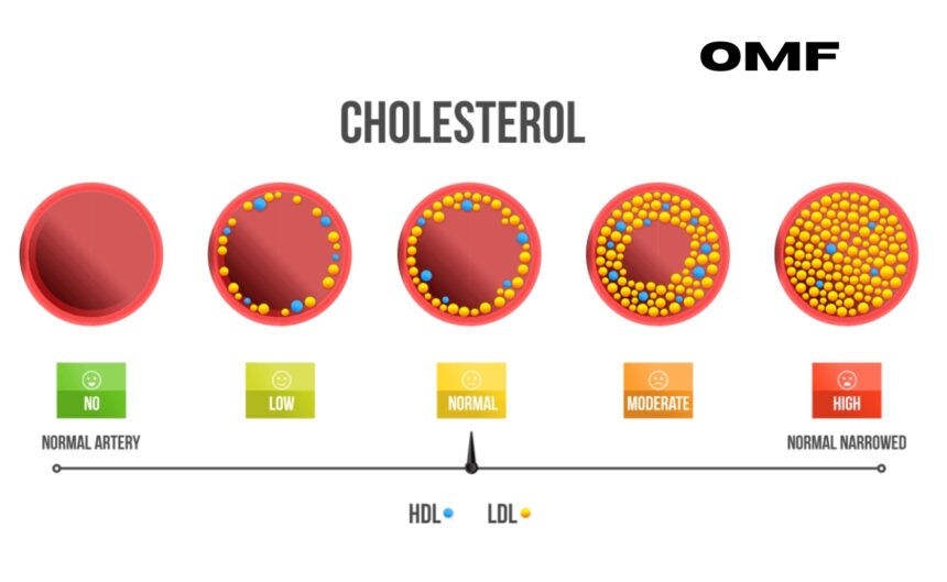 manage your cholesterol levels