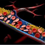 triglyceride