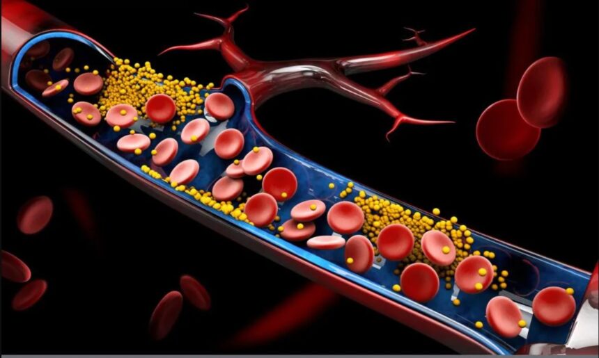 triglyceride