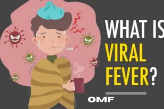 viral fever