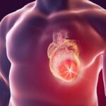 Heart attack causes and treatments