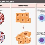 blood cancer