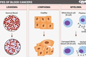 blood cancer