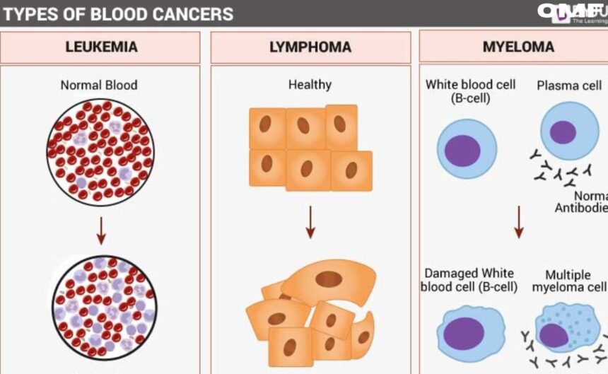 blood cancer